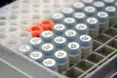 Close up of the tops of a tray of frozen samples labeled AC1V P35 through AC1V 58